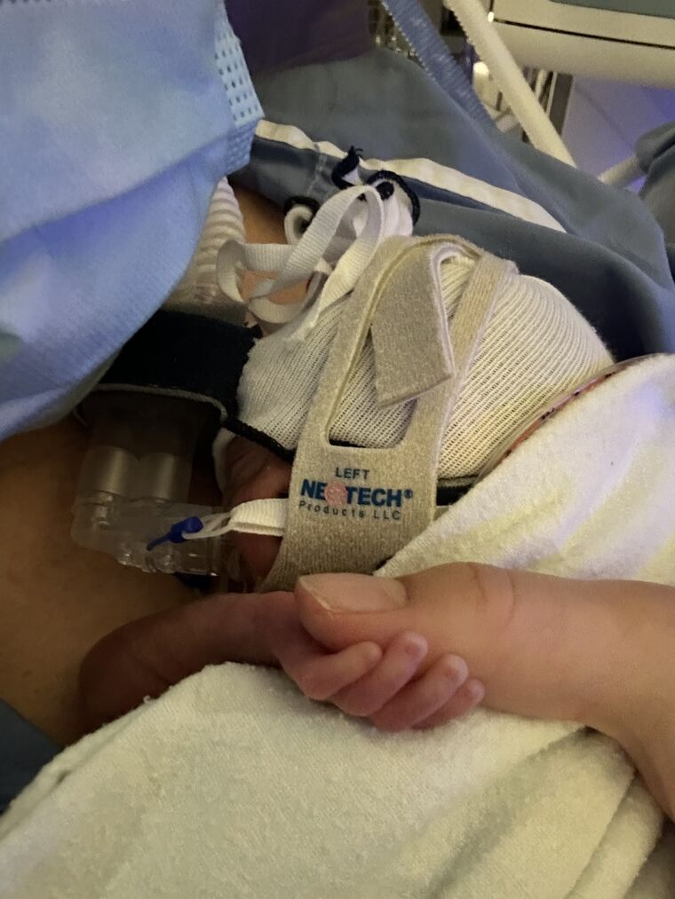 An adult finger gently held by Brooklyn's tiny hand inside the incubator, breathing support visible behind her.